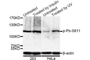 Western blot analysis of extracts of 293 and HeLa cells, using Phospho-Rb-S811 antibody (ABIN5969933) at 1/1000 dilution. (Retinoblastoma 1 抗体  (pSer811))