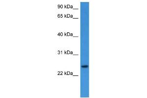 WB Suggested Anti-RHOG  Antibody Titration: 0. (RHOG 抗体  (C-Term))