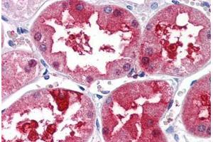 Human Kidney (formalin-fixed, paraffin-embedded) stained with PLXDC1 antibody ABIN351450 at 5 ug/ml followed by biotinylated goat anti-rabbit IgG secondary antibody ABIN481713, alkaline phosphatase-streptavidin and chromogen. (PLXDC1 抗体  (Internal Region))