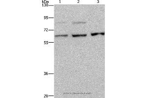 Western blot analysis of A431, MCF-7 and Hela cell, using KIF22 Polyclonal Antibody at dilution of 1:200 (KIF22 抗体)