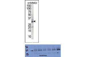 TOP: The anti-DSCR1 Pab is used in Western blot to detect DSCR1 in endothelial cell lysate. (RCAN1 抗体  (Middle Region))