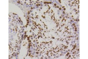 Paraformaldehyde-fixed, paraffin embedded mouse testis, Antigen retrieval by boiling in sodium citrate buffer (pH6) for 15min, Block endogenous peroxidase by 3% hydrogen peroxide for 30 minutes, Blocking buffer at 37°C for 20min, Antibody incubation with Histone H2A. (H2AFX 抗体  (pSer139))