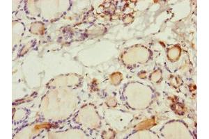 Immunohistochemistry of paraffin-embedded human thyroid tissue using ABIN7170586 at dilution of 1:100 (SPICE1 抗体  (AA 1-220))