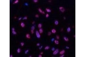 Immunofluorescence analysis of Human uterus tissue using Desmin Monoclonal Antibody at dilution of 1:200. (Desmin 抗体)