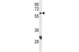 Western blot analysis of CD4 antibody and CEM lysate; Expected size: 40~60 kDa depending on glycosylation level (CD4 抗体  (AA 58-86))