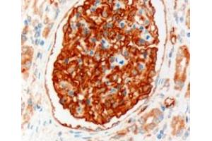 ABIN185496 (3µg/ml) staining of paraffin embedded Human Kidney. (SLC9A3R2 抗体  (Internal Region))