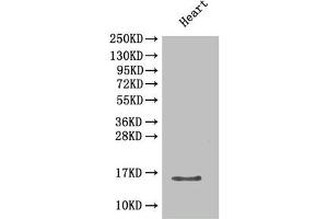 Western Blot Positive WB detected in: Mouse heart tissue All lanes: Cxcl5 antibody at 2 μg/mL Secondary Goat polyclonal to rabbit IgG at 1/50000 dilution Predicted band size: 15 kDa Observed band size: 15 kDa (CXCL5 抗体  (AA 46-117))