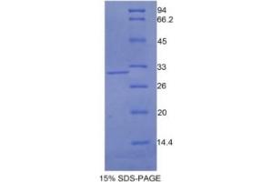 SDS-PAGE of Protein Standard from the Kit (Highly purified E. (N-Cadherin ELISA 试剂盒)