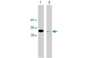 Western blot using FHL2 polyclonal antibody on HeLa cell extract (10 ug/lane). (FHL2 抗体)