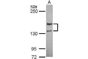 WB Image Sample (30 ug of whole cell lysate) A: Jurkat 5% SDS PAGE antibody diluted at 1:1000 (NMDAR2A 抗体  (N-Term))