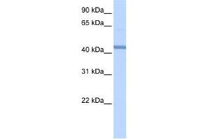 WB Suggested Anti-RBM22 Antibody Titration:  0.