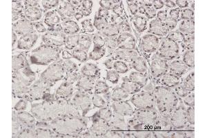 Immunoperoxidase of purified MaxPab antibody to RBM5 on formalin-fixed paraffin-embedded human stomach. (RBM5 抗体  (AA 1-546))