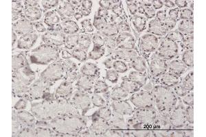Immunoperoxidase of purified MaxPab antibody to RBM5 on formalin-fixed paraffin-embedded human stomach.