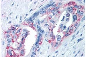 Immunohistochemistry (IHC) image for anti-Transient Receptor Potential Cation Channel, Subfamily M, Member 8 (TRPM8) (Internal Region) antibody (ABIN1049436)