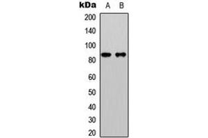 Western blot analysis of Beta-catenin (pS33) expression in HeLa (A), HepG2 (B) whole cell lysates. (beta Catenin 抗体  (N-Term, pSer33))