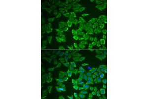 Immunofluorescence analysis of HeLa cell using CRHBP antibody. (CRHBP 抗体)