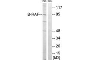 Western blot analysis of extracts from 293 cells, treated with insulin 0. (SNRPE 抗体  (AA 411-460))