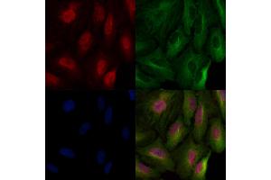 Histone H3 Antibody staining A549 cells by IF/ICC. (Histone 3 抗体)