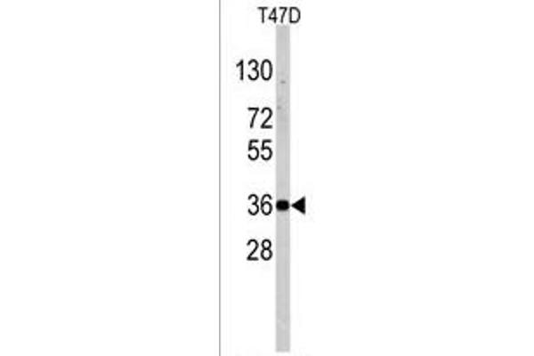 Nanos Homolog 1 抗体  (C-Term)