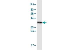 Western Blotting (WB) image for anti-Collagen, Type XIX, alpha 1 (COL19A1) (AA 27-114) antibody (ABIN2565454)