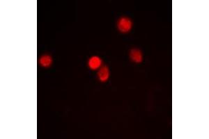 Immunofluorescence (IF) image for anti-Zinc Finger, MYND-Type Containing 8 (ZMYND8) (Center) antibody (ABIN7301454)