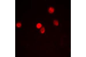 Immunofluorescent analysis of RACK7 staining in Hela cells. (ZMYND8 抗体  (Center))