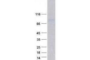 Validation with Western Blot