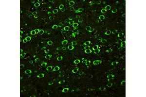 Anti-SSH3BP1 antibody, IHC(P) IHC(P): Rat Brain Tissue (ABI1 抗体  (C-Term))