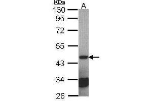 WB Image Sample (30 ug of whole cell lysate) A: NT2D1 10% SDS PAGE antibody diluted at 1:2000 (Septin 2 抗体)