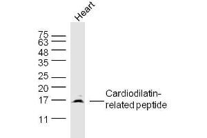 Mouse heart lysates probed with Cardiodilatin-related peptide Polyclonal Antibody, Unconjugated  at 1:300 dilution and 4˚C overnight incubation. (NPPA 抗体  (AA 26-55))