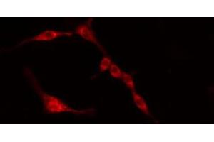 ABIN6274384 staining HeLa cells by IF/ICC. (PFKFB3 抗体)