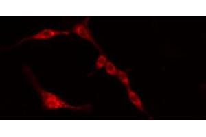 ABIN6274384 staining HeLa cells by IF/ICC. (PFKFB3 抗体)