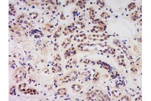 Formalin-fixed and paraffin embedded human kidney labeled with Anti-Caspase-6 (NT) Polyclonal Antibody, Unconjugated  at 1:500 followed by conjugation to the secondary antibody and DAB staining. (Caspase 6 抗体  (AA 27-130))