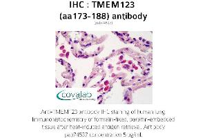 Image no. 1 for anti-Transmembrane Protein 123 (TMEM123) (AA 173-188) antibody (ABIN1740149) (TMEM123 抗体  (AA 173-188))