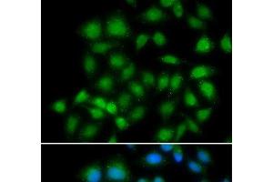Immunofluorescence analysis of HeLa cells using MXI1 Polyclonal Antibody (MXI1 抗体)