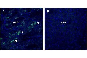 Stromal interaction molecule 2 (STIM2) in mouse nucleus basalis (NBM) regionA. (Stim2 抗体  (Intracellular))