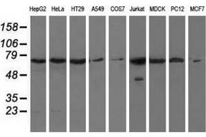 Western blot analysis of extracts (35 µg) from 9 different cell lines by using anti-HAO1 monoclonal antibody.