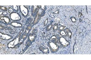 IHC analysis of Carbonic Anhydrase I/CA1 using anti-Carbonic Anhydrase I/CA1 antibody (ABIN7602620). (CA1 抗体  (AA 9-261))