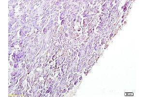 Formalin-fixed and paraffin embedded mouse pancreas labeled with Anti-4 Hydroxynonenal Polyclonal Antibody, Unconjugated (ABIN873270) at 1:200 followed by conjugation to the secondary antibody and DAB staining. (HNE 抗体)