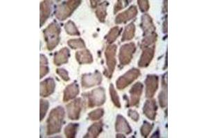 Immunohistochemistry (Paraffin-embedded Sections) (IHC (p)) image for anti-Low Density Lipoprotein Receptor-Related Protein 12 (LRP12) (AA 642-671), (C-Term) antibody (ABIN953208)