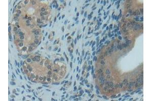 DAB staining on IHC-P; Samples: Rat Uterus Tissue (TXN 抗体  (AA 1-105))