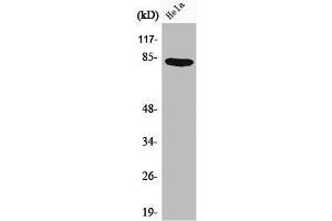 Western Blot analysis of HeLa cells using Catenin-γ Polyclonal Antibody (JUP 抗体  (C-Term))