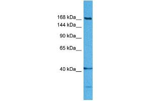 Host:  Rabbit  Target Name:  DISP1  Sample Tissue:  Human MDA-MB-435s Whole Cell  Antibody Dilution:  1ug/ml (DISP1 抗体  (Middle Region))