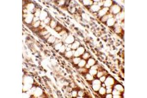 Immunohistochemistry of Periphilin in human colon tissue with Periphilin antibody at 2. (PPHLN1 抗体  (Middle Region))