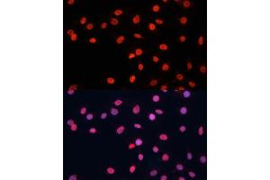 Immunofluorescence analysis of C6 cells using FUS antibody (ABIN6127938, ABIN6140818, ABIN6140819 and ABIN7101788) at dilution of 1:100. (FUS 抗体  (AA 297-526))