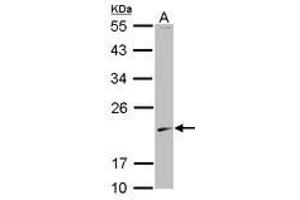 Image no. 1 for anti-S-Phase Kinase-Associated Protein 1 (SKP1) (AA 1-110) antibody (ABIN1500945) (SKP1 抗体  (AA 1-110))