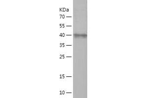 Western Blotting (WB) image for ADAM Metallopeptidase Domain 8 (ADAM8) (AA 188-373) protein (His-IF2DI Tag) (ABIN7121692) (ADAM8 Protein (AA 188-373) (His-IF2DI Tag))