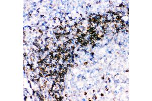 Anti- CD79A picoband antibody, IHC(P) IHC(P): Human Tonsil Tissue (CD79a 抗体  (AA 121-226))
