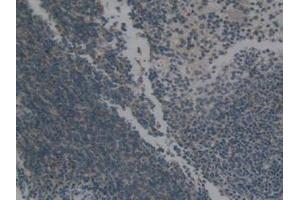 Detection of Hsp60 in Mouse Spleen Tissue using Polyclonal Antibody to Heat Shock Protein 60 (Hsp60) (HSPD1 抗体  (AA 316-573))