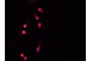 ABIN6267234 staining HeLa cells by IF/ICC.